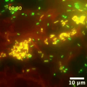 listeria dans vacuoles 