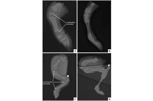 Identification de nouveaux modèles génétiques bovins pour l’étude d’une anomalie squelettique humaine
