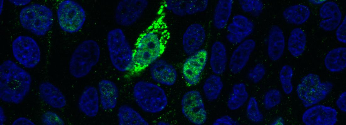 illustration Influenza, coronavirus et autres : quand les virus d’origine animale contaminent l’homme