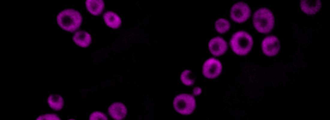 illustration Une nouvelle méthode d’imagerie cellulaire non-invasive révèle la structure des gouttelettes lipidiques