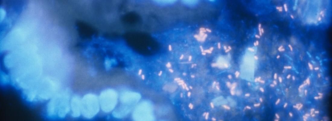 illustration L’effet potentiel des statines pour restaurer le microbiote chez les personnes obèses
