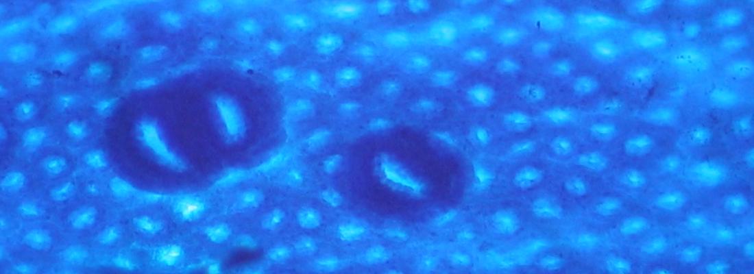 illustration Additif alimentaire E171 : les premiers résultats de l’exposition orale aux nanoparticules de dioxyde de titane