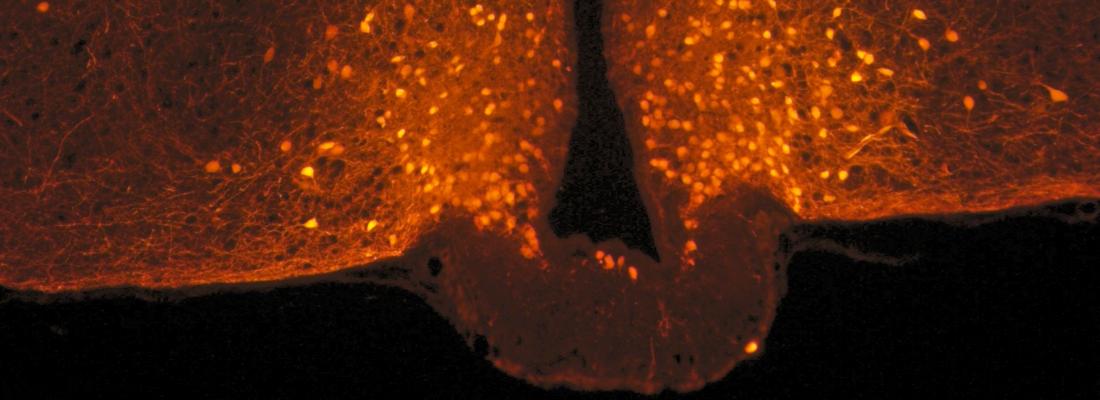 illustration The origin of satiety: brain cells that change shape after a meal