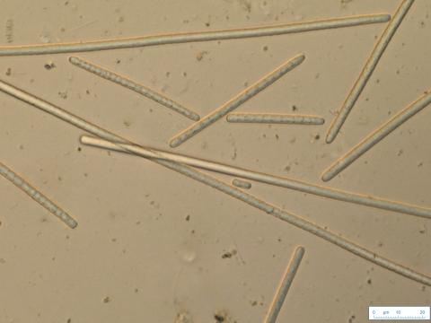 Observation microscopique à x600 de l’espèce