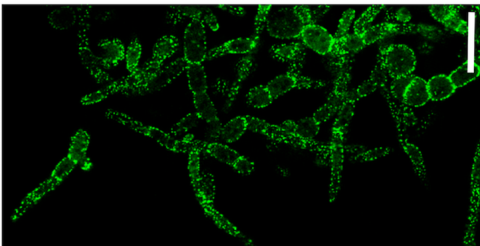 Observation en microscopie confocale de AbPil1AGFP chez A. brassicicola. Echelle : 50 µm