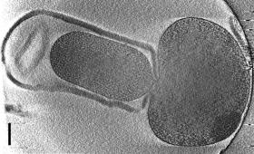 Bactérie Listeria en train de perdre sa paroi