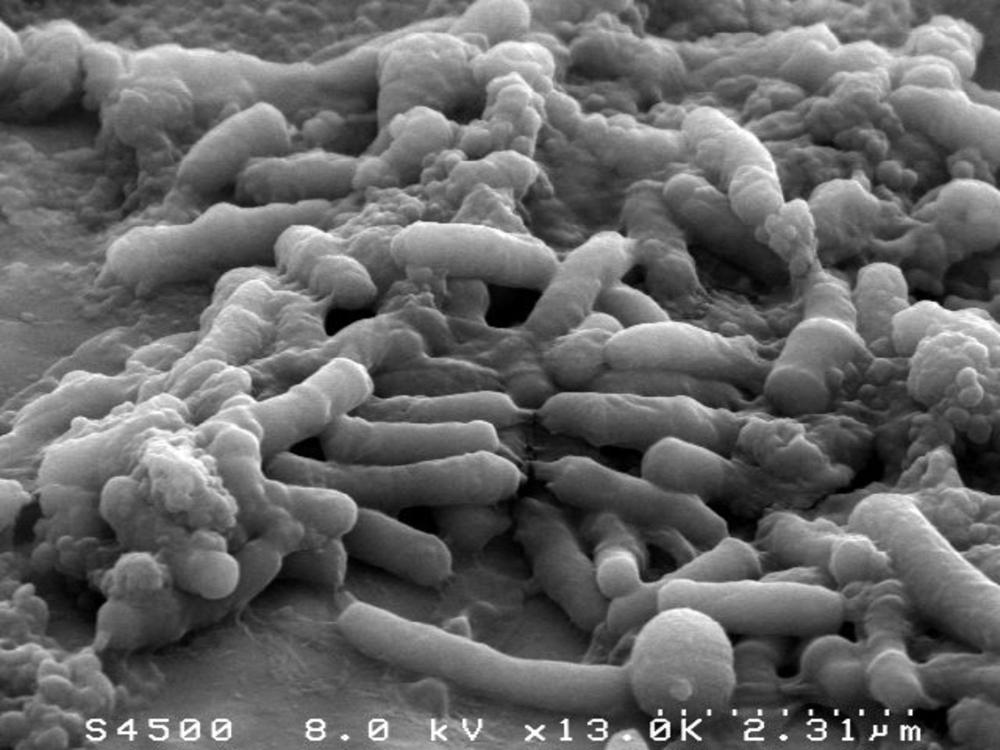 Les bactéries, les médicaments de demain ?