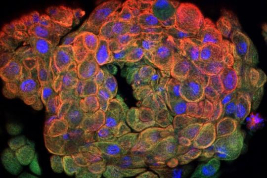  Les organoïdes : des organes miniatures aujourd’hui incontournables pour la biologie et la médecine 
