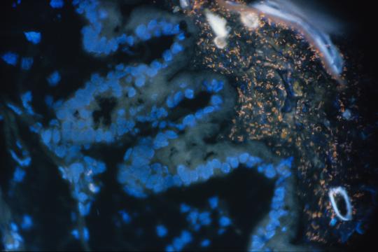 Faire du microbiome un levier mondial de santé globale
