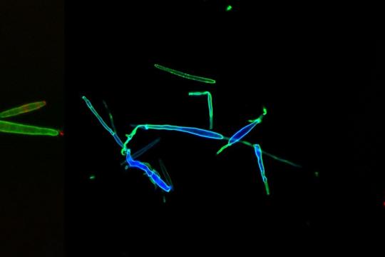 Une bourse ERC pour comprendre pourquoi les champignons oxydent les glucides de leur paroi cellulaire