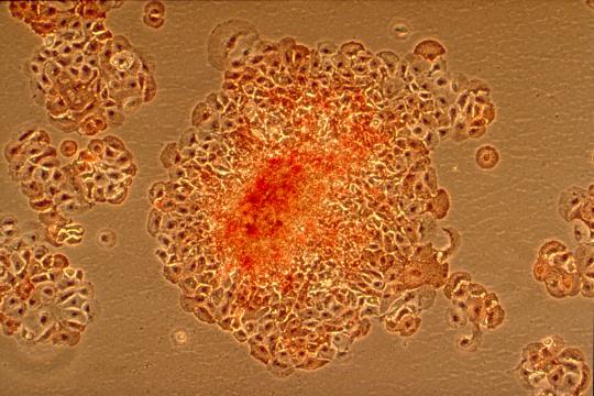 Promising anticancer research using protozoa