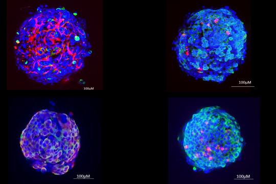 Un mini-foie humain pour révolutionner l’étude toxicologique des contaminants