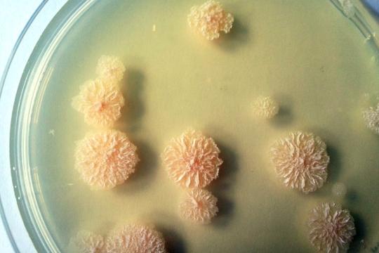 Quand l’IA permet de mieux comprendre la virulence des mycobactéries pathogènes pour lutter contre les infections
