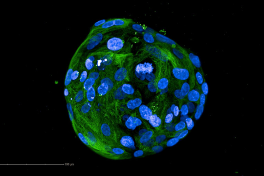 REPLAY sciences pour tous : "Organoïdes : des outils pour une meilleure santé digestive"