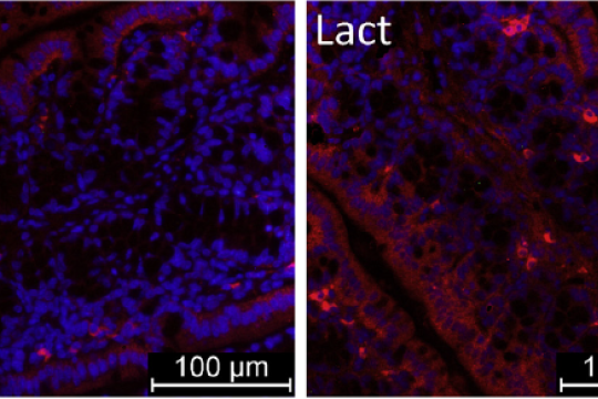 Syndrome de l’intestin irritable : un nouveau mécanisme expliquant la douleur abdominale 